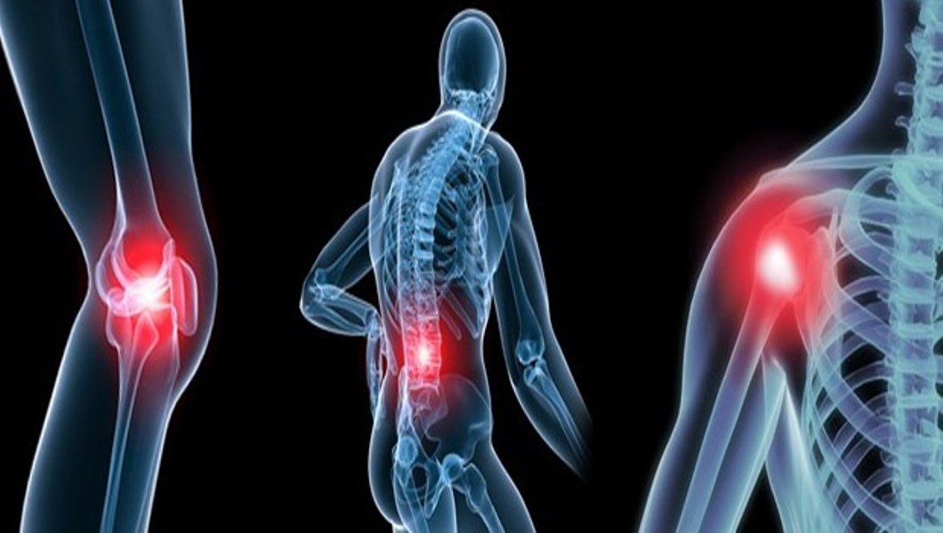 Que savezvous sur l’arthrose ? Clinique Francheville